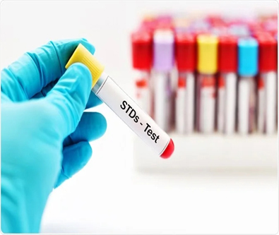 Venereal Diseases