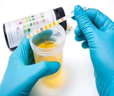 URINE